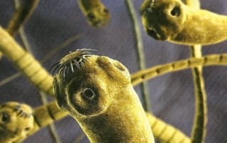 Worms in your body are a leading cause of hyper-infection of bacteria. - hyper-infection of bacteria; good hygiene; tapeworms; immune system suppression; chronic; pathogenic microbes;